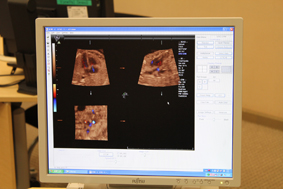 GEヘルスケアの医療画像システムが胎児の心臓の動きを高精細に精密に映し出す